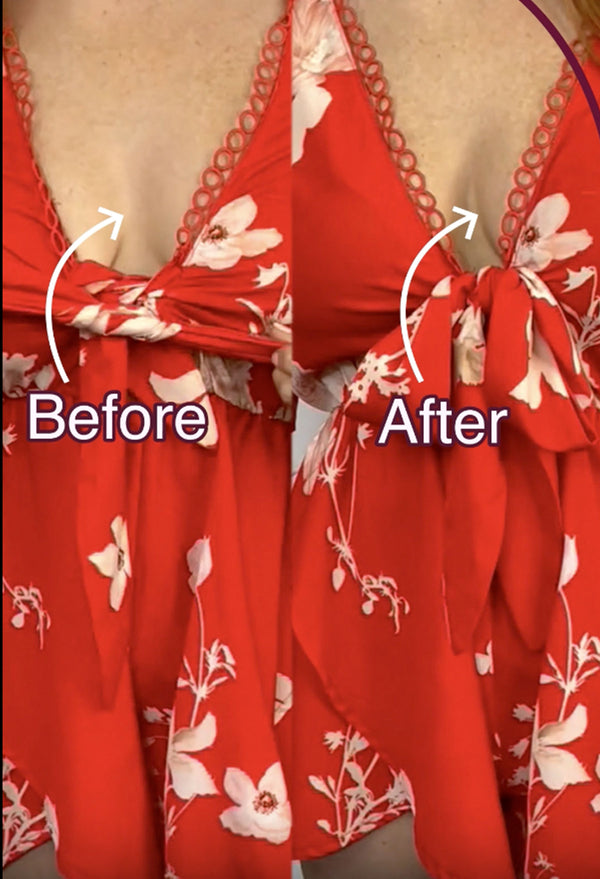 Bunny Breast Lift Cups